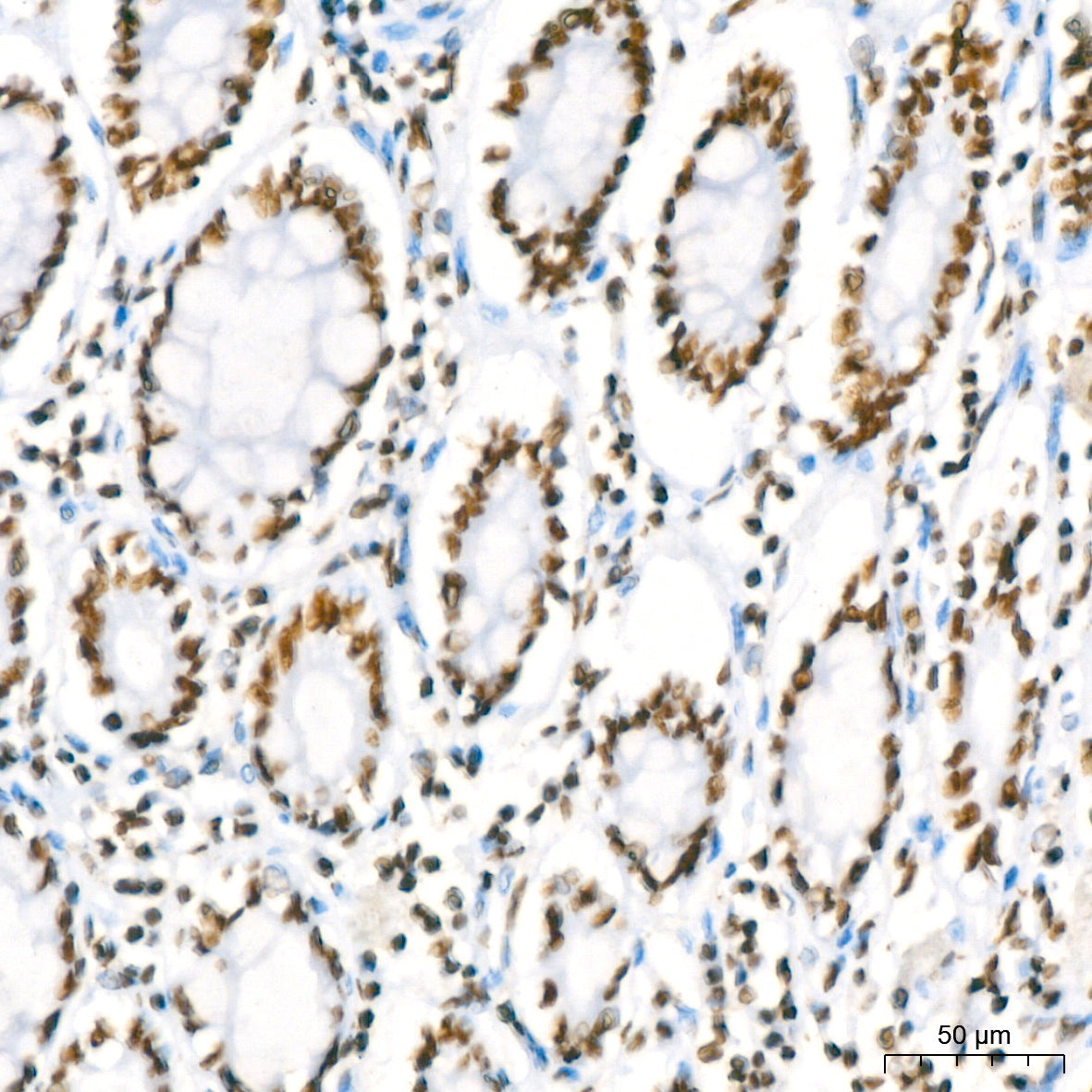 RBBP4 Rabbit mAb