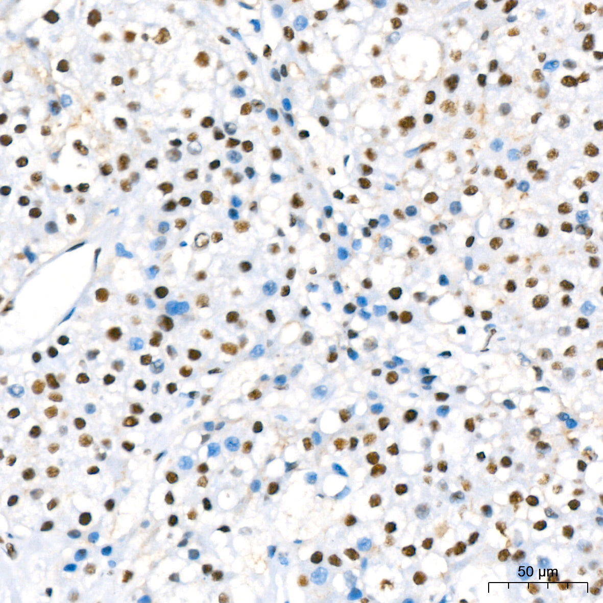 RBBP4 Rabbit mAb