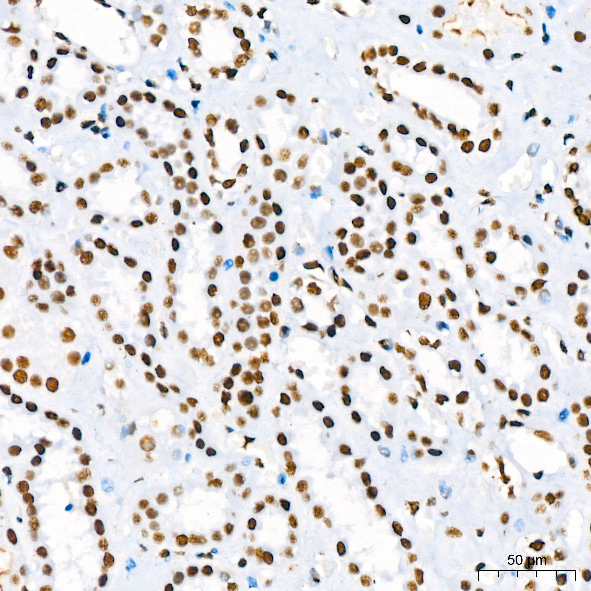 RBBP4 Rabbit mAb