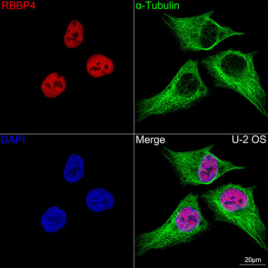 RBBP4 Rabbit mAb
