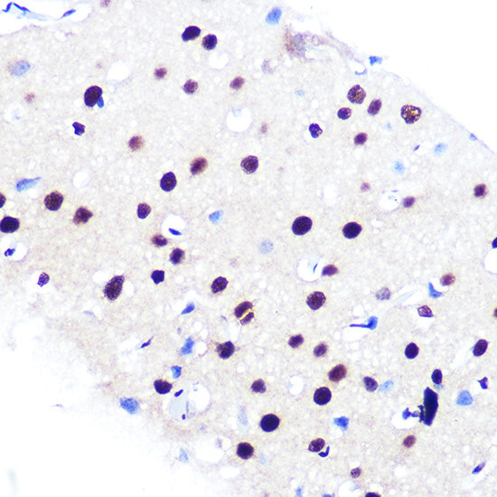 RBBP4 Rabbit mAb
