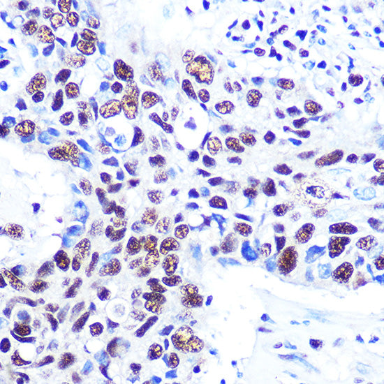 RBBP4 Rabbit mAb