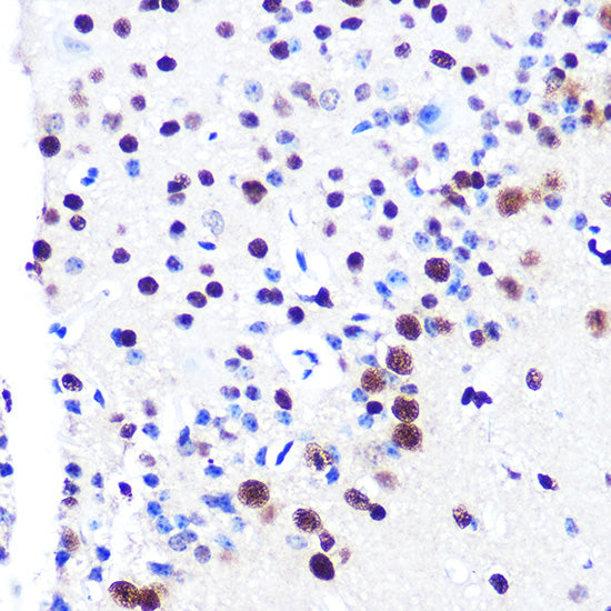 RBBP4 Rabbit mAb