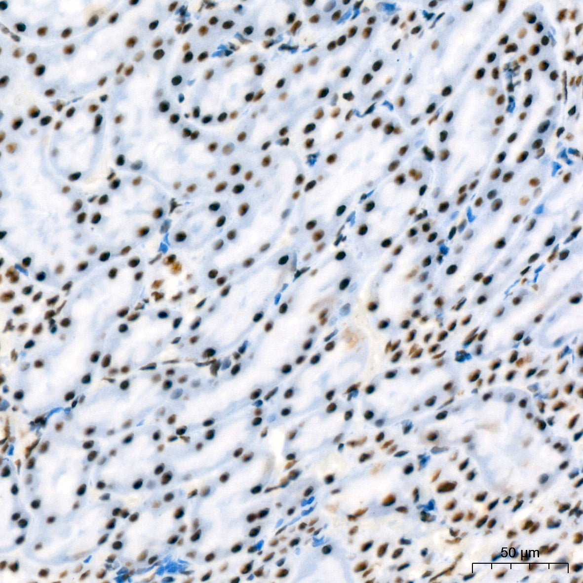 RBBP4 Rabbit mAb