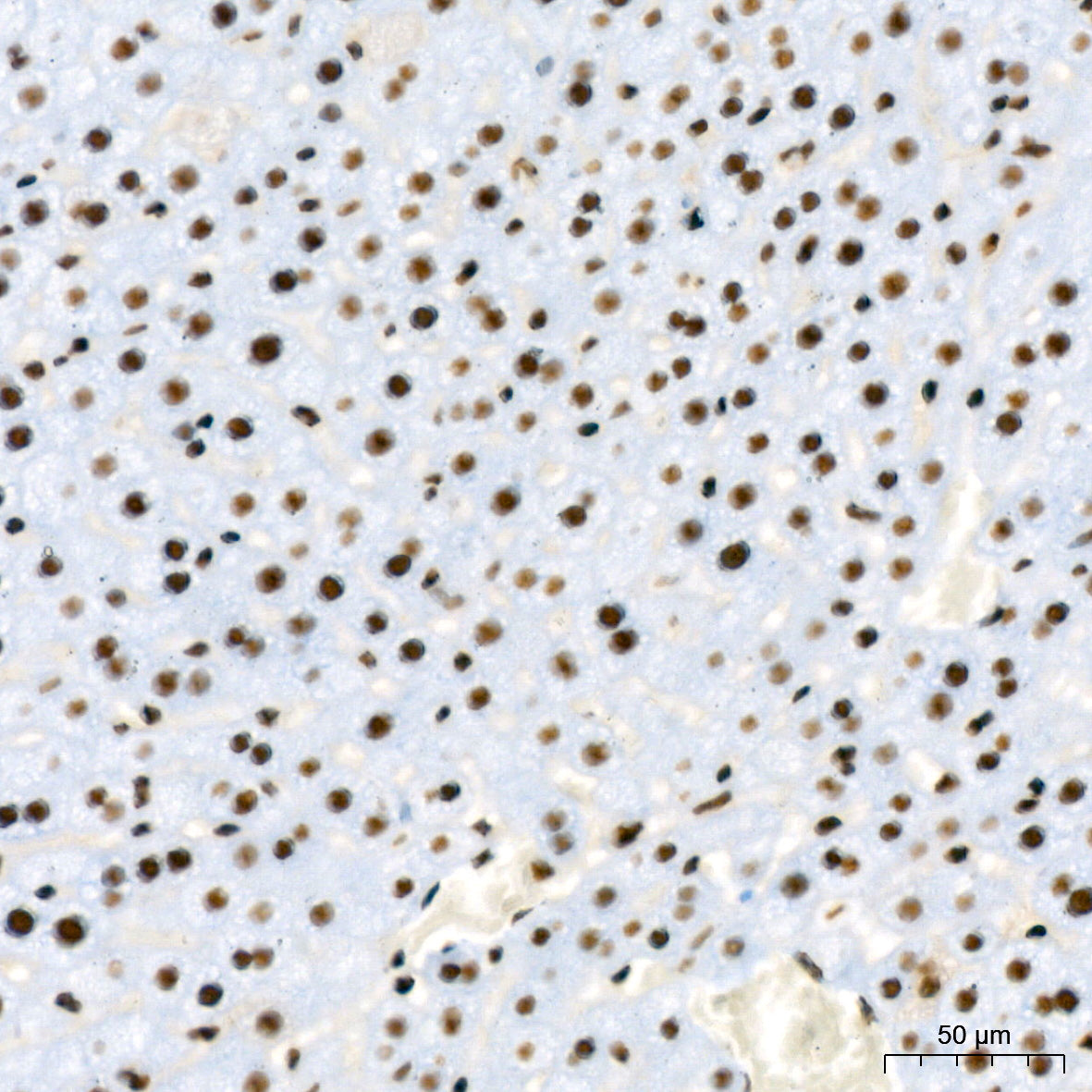 RBBP4 Rabbit mAb