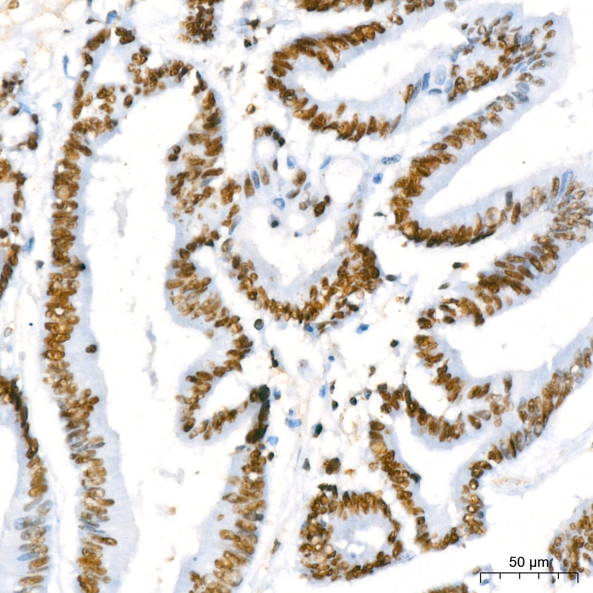 RBBP4 Rabbit mAb
