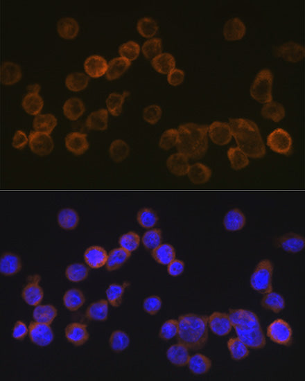 CD35/CR1 Rabbit mAb