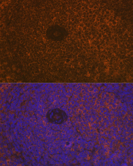 CD35/CR1 Rabbit mAb