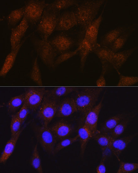 PSMD4 Rabbit mAb