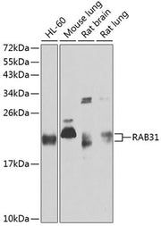 RAB31 Rabbit pAb