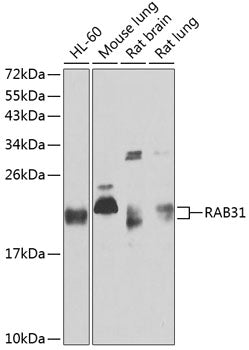 RAB31 Rabbit pAb