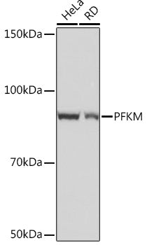 PFKM Rabbit mAb