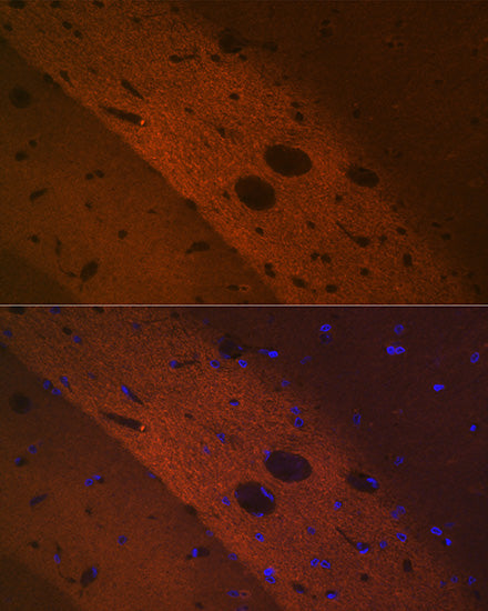 mGluR2 Rabbit mAb