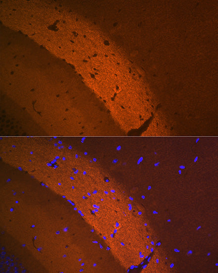mGluR2 Rabbit mAb