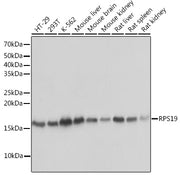 RPS19 Rabbit mAb
