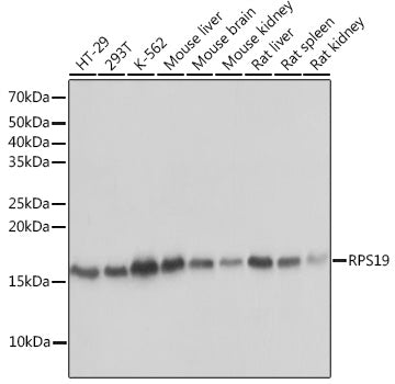 RPS19 Rabbit mAb