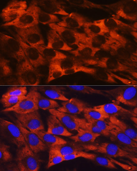 RPS19 Rabbit mAb