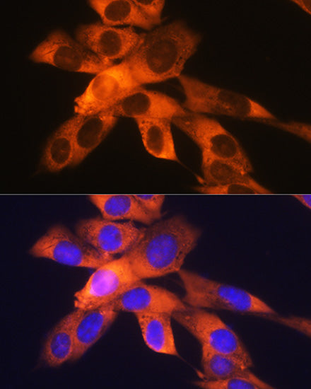RPS19 Rabbit mAb