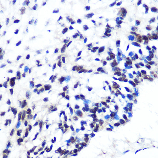 POU2F1/OCT1 Rabbit mAb