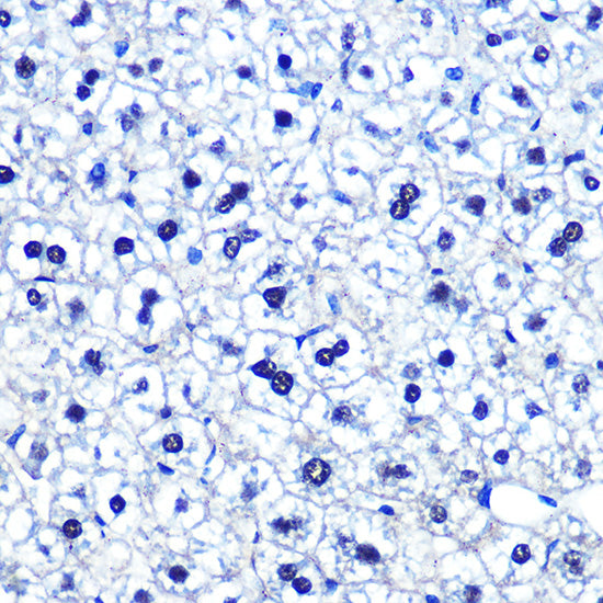 POU2F1/OCT1 Rabbit mAb