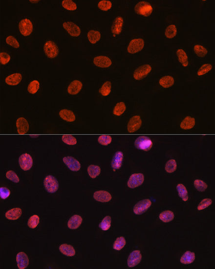 U1A/SNRPA Rabbit mAb