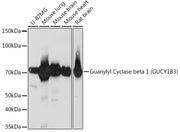 Guanylyl Cyclase beta 1 (GUCY1B3) Rabbit mAb