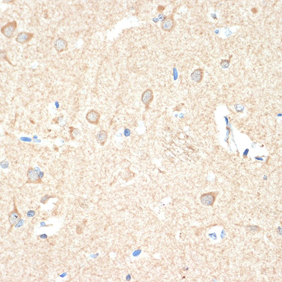 Guanylyl Cyclase beta 1 (GUCY1B3) Rabbit mAb
