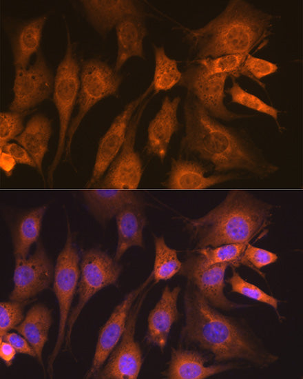 Guanylyl Cyclase beta 1 (GUCY1B3) Rabbit mAb
