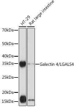 Galectin 4/LGALS4 Rabbit mAb
