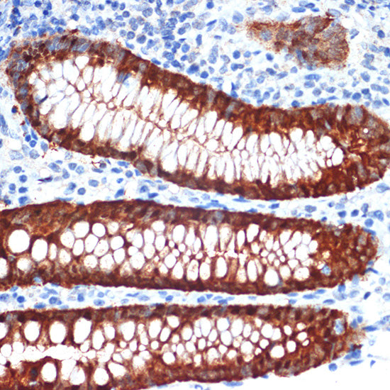 Galectin 4/LGALS4 Rabbit mAb