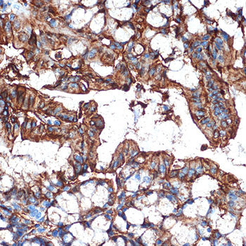 Galectin 4/LGALS4 Rabbit mAb