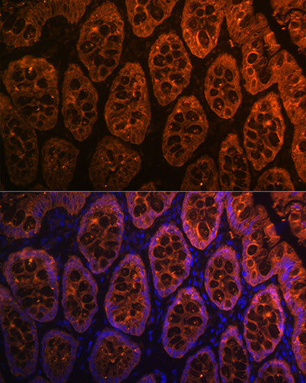 Galectin 4/LGALS4 Rabbit mAb