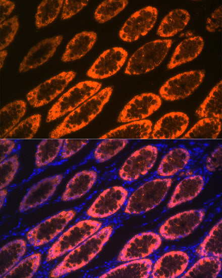 Galectin 4/LGALS4 Rabbit mAb