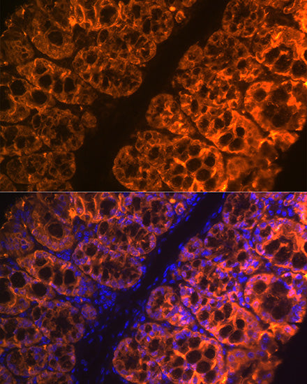 Galectin 4/LGALS4 Rabbit mAb