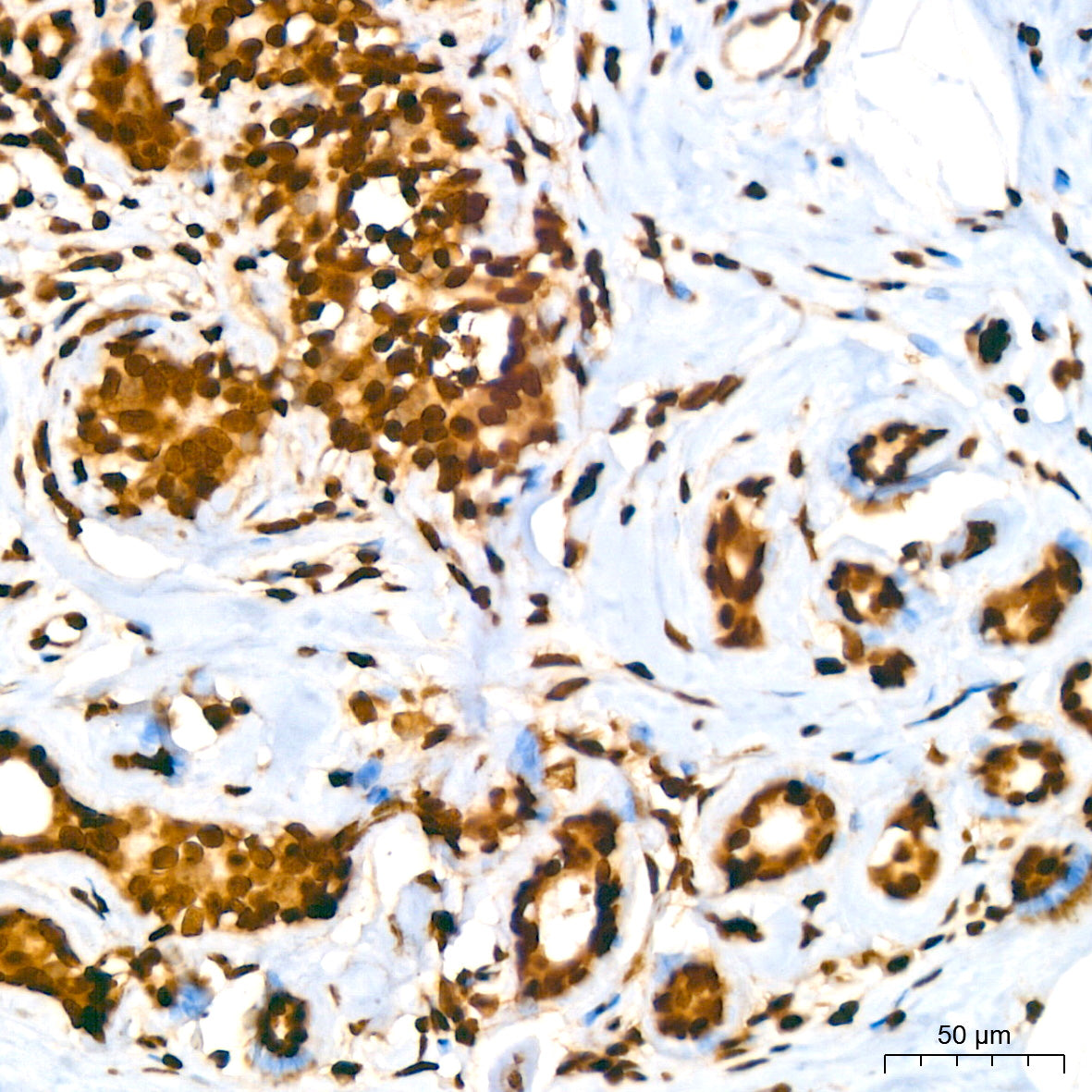 Histone H2A Rabbit mAb