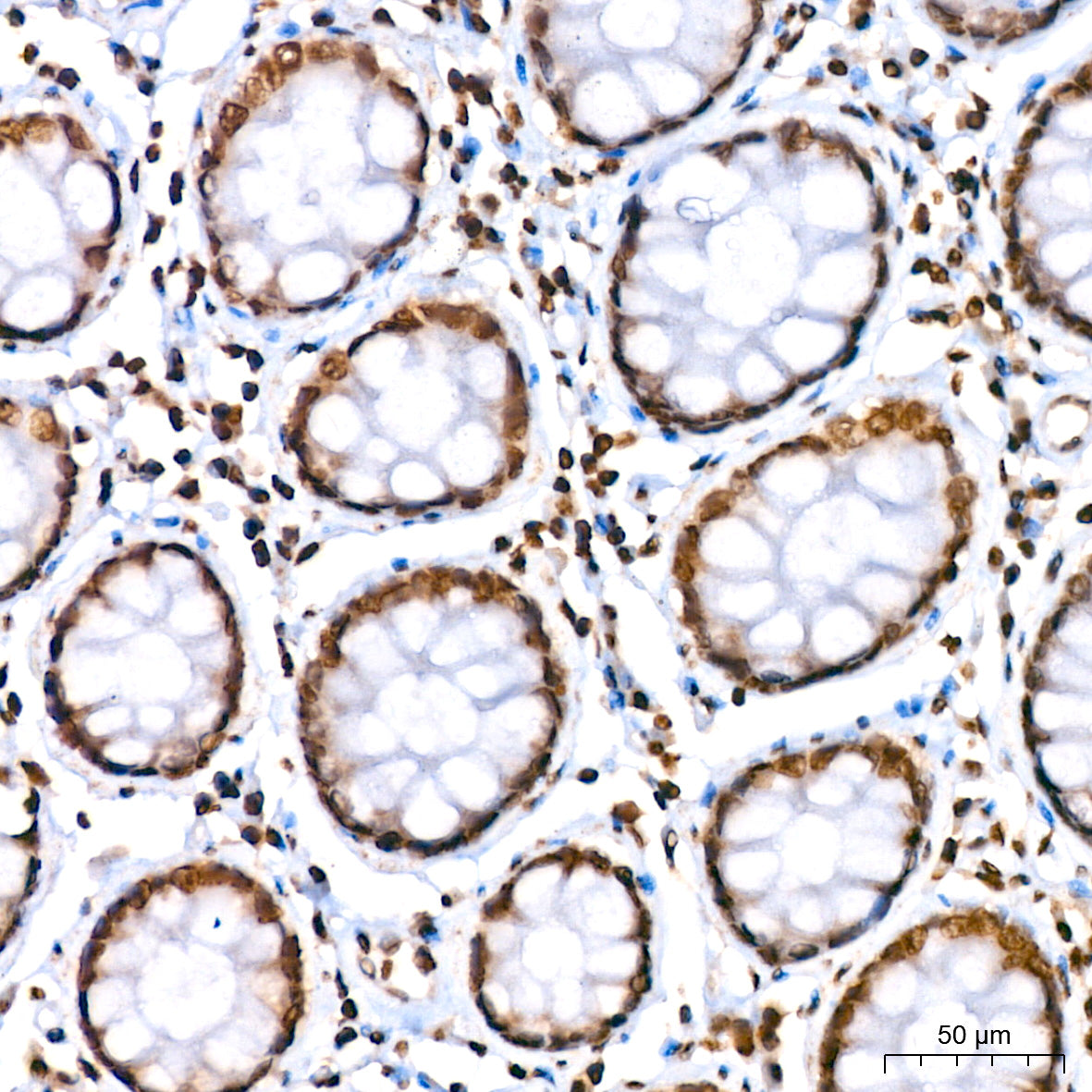 Histone H2A Rabbit mAb