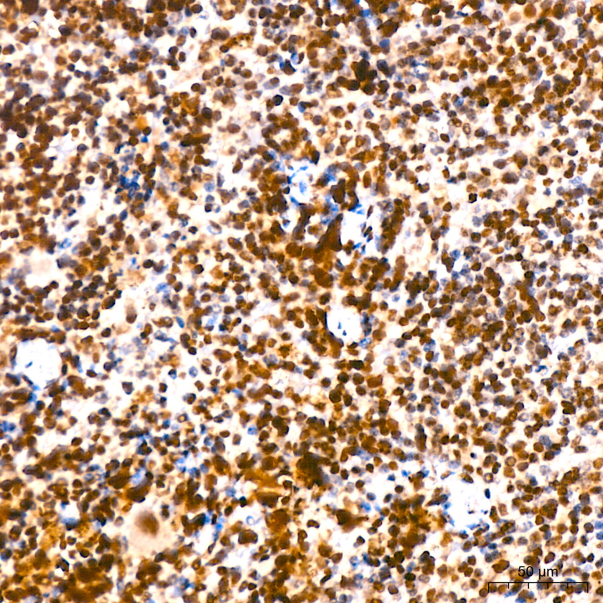 Histone H2A Rabbit mAb