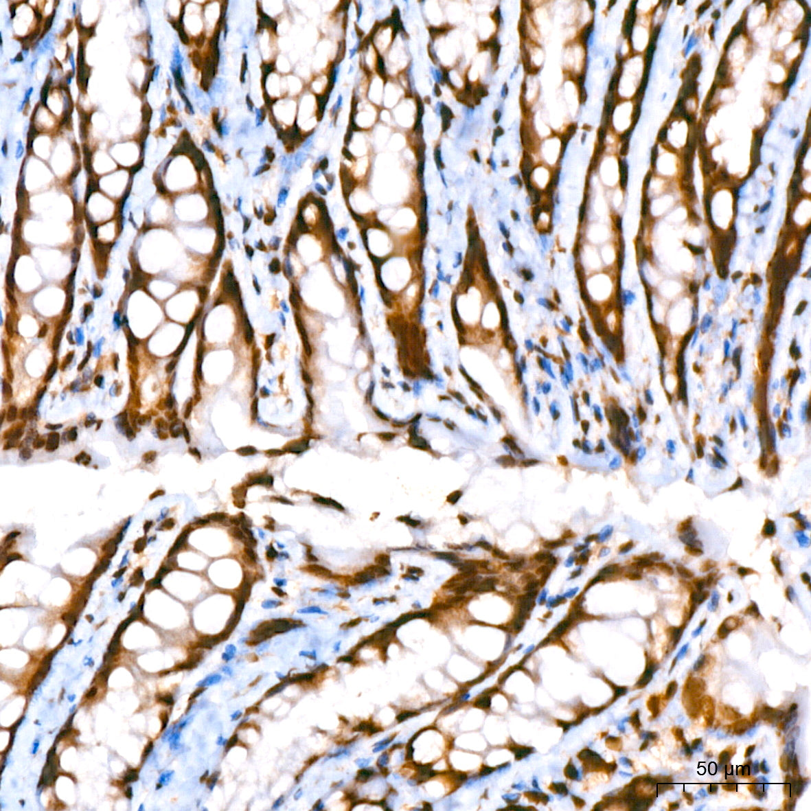 Histone H2A Rabbit mAb