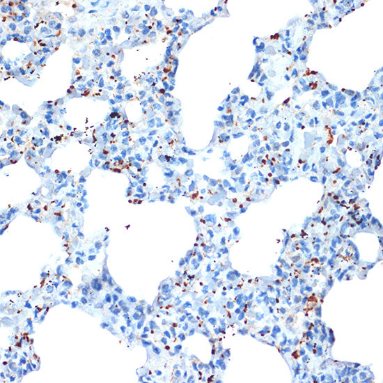 CXCL4/PF4 Rabbit mAb