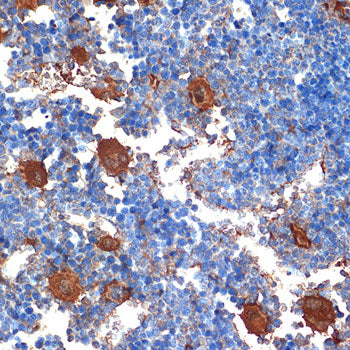CXCL4/PF4 Rabbit mAb