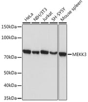 MEKK3 Rabbit mAb