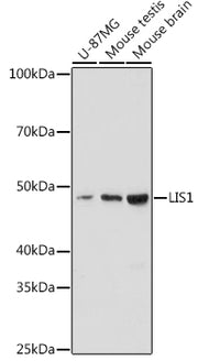 LIS1 Rabbit mAb