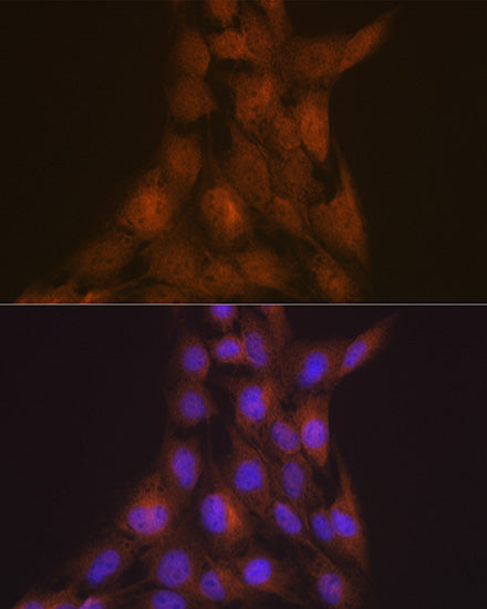 LIS1 Rabbit mAb