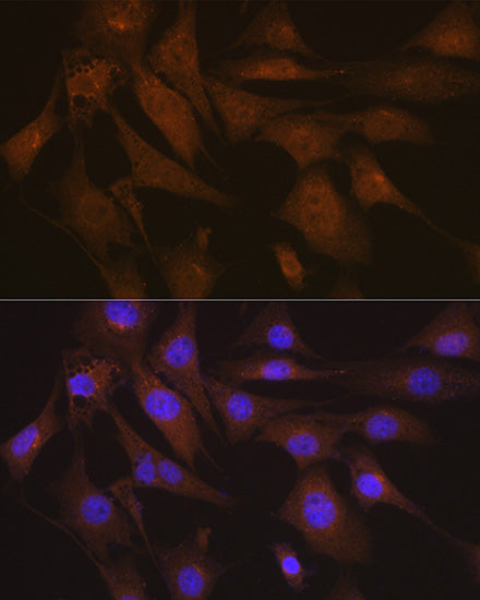 LIS1 Rabbit mAb