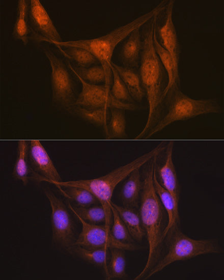 LIS1 Rabbit mAb