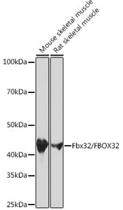Fbx32/FBXO32 Rabbit mAb