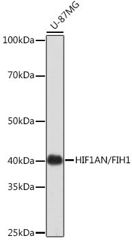 [KO Validated] HIF1AN/FIH1 Rabbit mAb