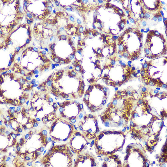 NOXA2/p67phox Rabbit mAb