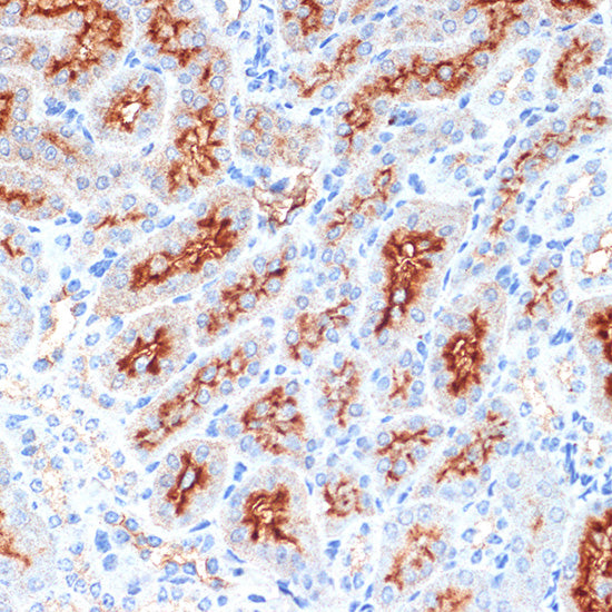 Syntaxin 3 Rabbit mAb