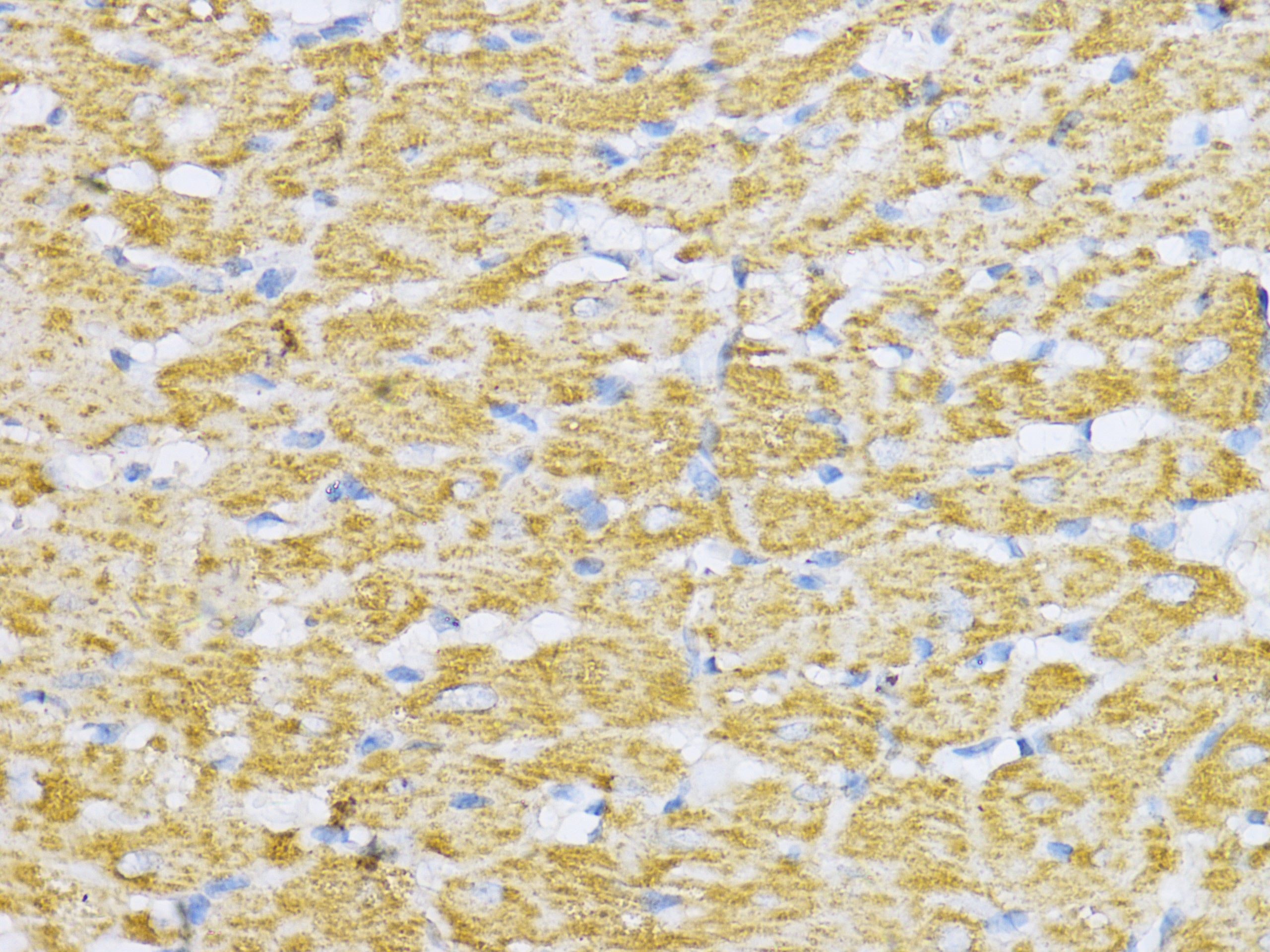 Aconitase 2 (ACO2) Rabbit pAb